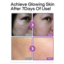 Load image into Gallery viewer, Galactomy Bakuchiol Serum 1.01Fl.Oz/30Ml, Retinol Face Serum, Niacinamide 2%, Panthenol, Collagen, Wrinkle Care, for Sensitive Skin, Daily Anti-Aging Facial Serum Korean Skincare