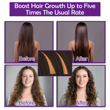 Load image into Gallery viewer, Hair Growth Shampoo and Conditioner Set with Rosemary, Biotin, Argan, and Castor Oils for Thinning, Damaged, Curly Hair