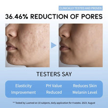 Load image into Gallery viewer, AHA BHA Serum Korean Overnight Face Serum, Acne Serum for Oliy & Sensitive Skin, Exfoliating Face Serum P.M, AHA BHA PHA, Papain, Cell Turnover Refine Serum Cream 50G