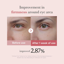 Load image into Gallery viewer, Eye Serum with Salmon DNA PDRN & Pink Peptides | 99% Purity Retinol for Fine Lines | PDRN & Niacinamide for Uneven Skin Tone | Korean Skincare, 1.01 Fl.Oz