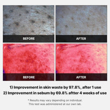 Load image into Gallery viewer, Medicube Red Succinic Acid Peeling Pad | Red Succinic Acid Panthenol Pads