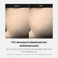Load image into Gallery viewer, Medicube Zero Pore One-Day Serum Overnight Resurfacing Reduction in Pore Appearance after One Day of Use Serum