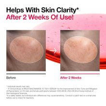 Load image into Gallery viewer, Niacinamide 10 + TXA 4 Serum, Dark Spot Care, Hyaluronic Acid, Tranexamic Acid, Lightweight & Hydrating All-In-One Daily Facial Serum for Glass Skin, Korean Skincare, 1.01 Fl.Oz