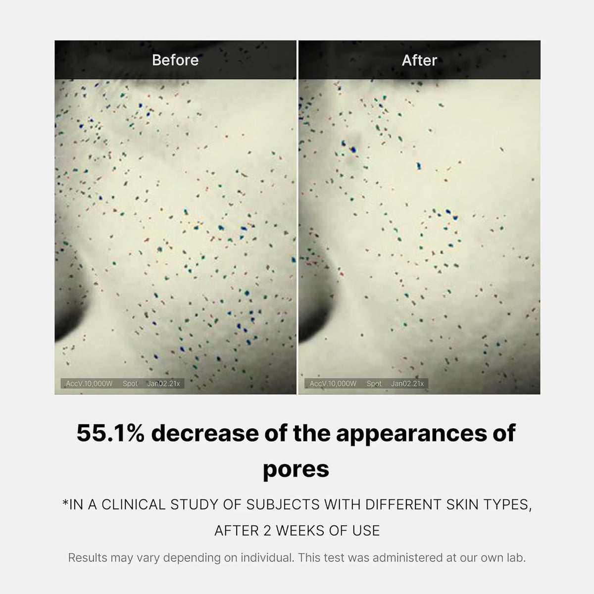 Transform Your Skin with Medicube Zero Pore One-Day Cream - The Ultimate Pore Refining Solution for a Radiant Complexion