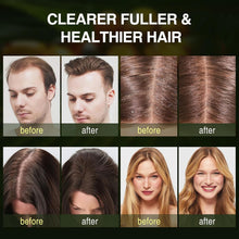 Load image into Gallery viewer, Batana Oil Hair Growth Shampoo, Strengthening Regrowth Shampoo for Men &amp; Women with Thinning Hair &amp; Hair Loss, Infused Rosemary, Mint Oil Nourishes Scalp, Sulfate Free for All Hair Types, 10.15 Fl.Oz
