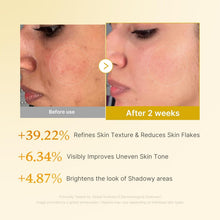 Load image into Gallery viewer, Kojic Acid Turmeric Smoothing Toner for Face &amp; Body | Lightweight Toner for Balancing Uneven Skin Tone &amp; Texture | Niacinamide, Glycolic Acid for Clear Glass Skin | 8.45 Fl.Oz
