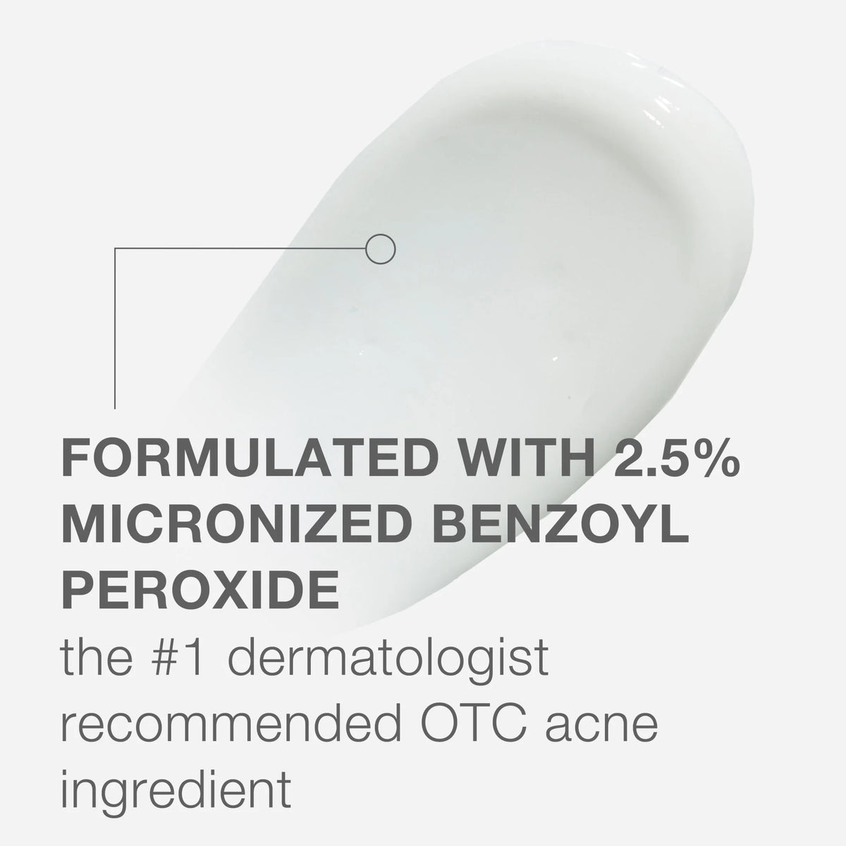 Stubborn Acne AM Treatment with Benzoyl Peroxide, 2.0 Oz
