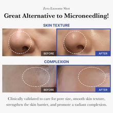 Load image into Gallery viewer, Medicube Zero Shot 7,500 PPM Spicule Facial Serum Liquid Skin Booster Serum Pore Care Dead Skin Cells Skin Korean Skin Care
