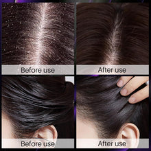 Load image into Gallery viewer, Champu De Cebolla Y Romero Con Biotina, Onion, Biotin and Rosemary Shampoo and Conditioner Set, Onion Shampoo for Hair Growth, Stronger, Thicker and Longer Hair (3 PCS)
