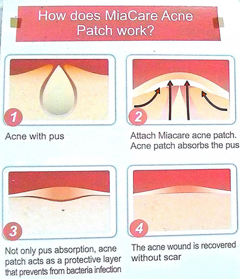 [ COSRX ] Acne Pimple Master Patch (24 Patches) 1 Sheet ~10 Sheets