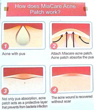 Load image into Gallery viewer, [ COSRX ] Acne Pimple Master Patch (24 Patches) 1 Sheet ~10 Sheets
