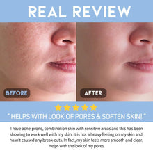 Load image into Gallery viewer, AHA BHA Serum Korean Overnight Face Serum, Acne Serum for Oliy &amp; Sensitive Skin, Exfoliating Face Serum P.M, AHA BHA PHA, Papain, Cell Turnover Refine Serum Cream 50G
