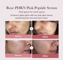 Load image into Gallery viewer, Revitalize Your Skin with PDRN Pink Peptide Serum - Powerful Regenerating Face Serum for All Skin Types - 1.01 Fl Oz
