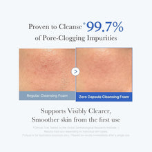 Load image into Gallery viewer, Medicube Zero Pore Clearing Capsule Cleansing Foam 120G-Pore Deep Cleansing
