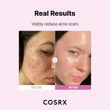Load image into Gallery viewer, the Niacinamide 15 Serum (0.68 Fl.Oz)
